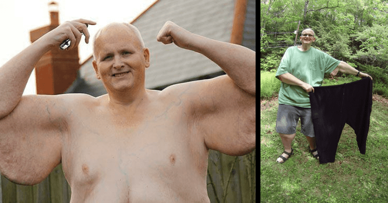 Former 'world's fattest man' moving from US to UK to avail $137,000 in free healthcare