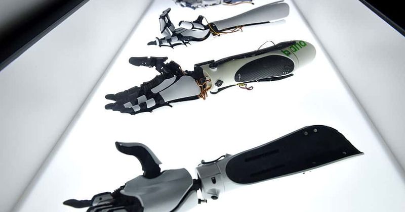 The woman with the golden arm: This Bionic Bride overcame her fears and found true love