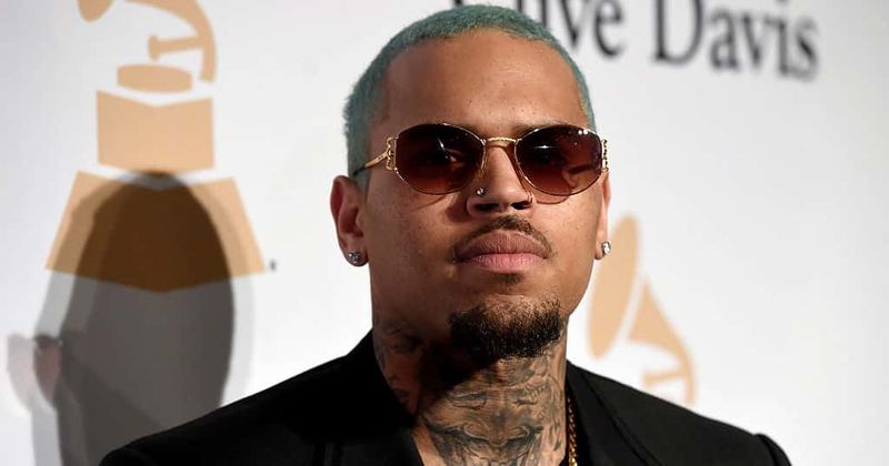 Model who sued Chris Brown for assault is fighting for life after complications during cosmetic procedure