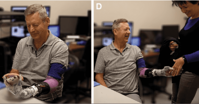 Utah amputee could ‘feel’ his wife’s touch when they shook hands, thanks to motorized prosthetic arm