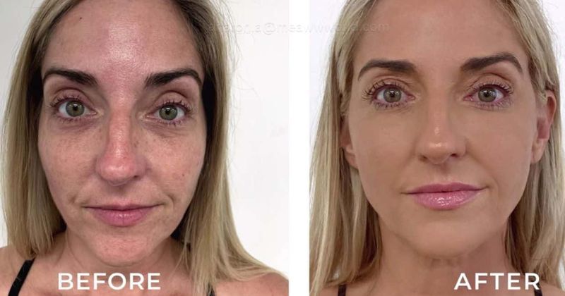 'Skin Decision: Before and After': Nurse Jamie helps Lauralee get her self-confidence back