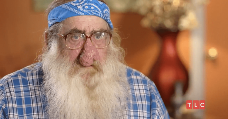 ‘Dr Pimple Popper’: Terry turns to Dr Sandra Lee for help with his rhinophyma