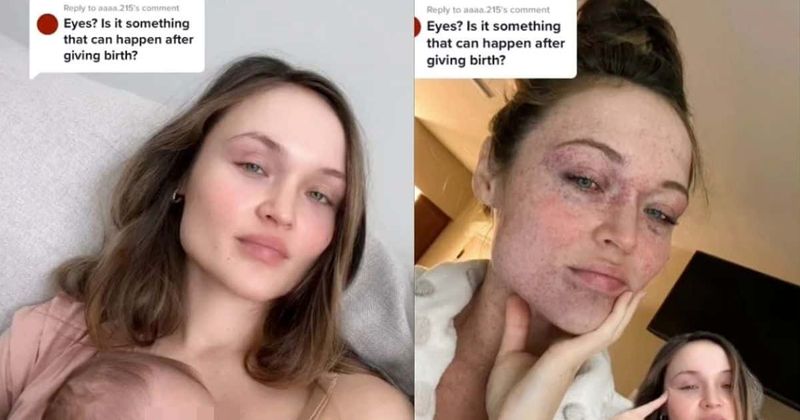 Viral video shares terrifying side effect of natural childbirth that's rarely talked about