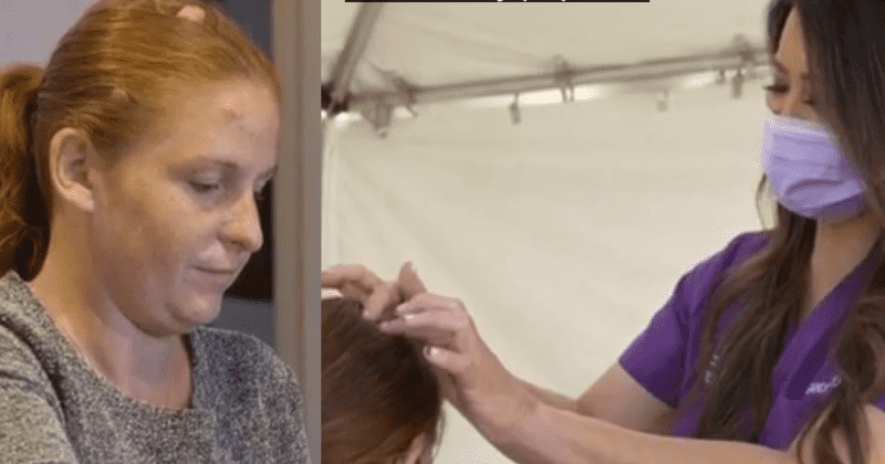 'Dr Pimple Popper': Shawnell kisses goodbye to lumps on her head and her edited pics