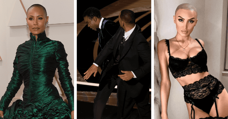 ZaraLena Jackson: Model with alopecia PRAISES Will Smith, says he 'showed strength'