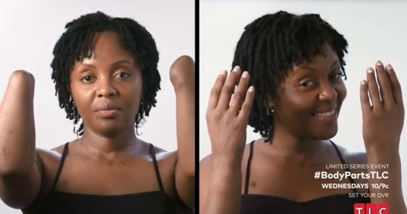 'Body Parts': Victoria Mugo praises Allison, calls her new prosthetics a 'victory'