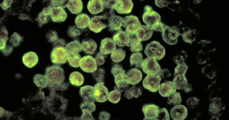 Missouri man dies after contracting brain-eating amoeba while swimming in Iowa lake