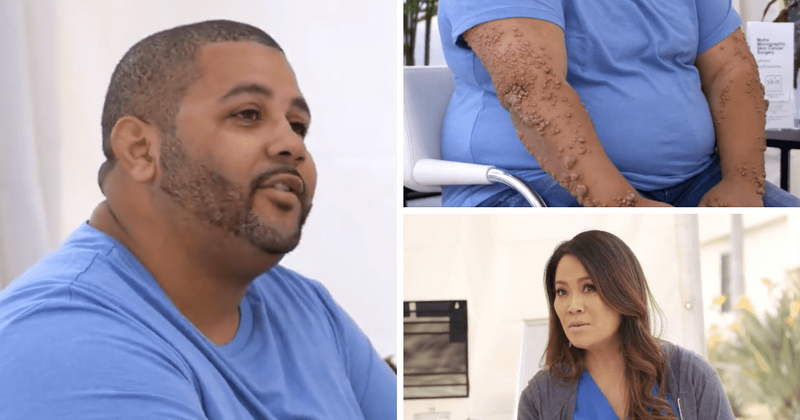 'Dr Pimple Popper' Season 8: Can Dr Lee treat Robert's Eruptive Xanthomas given his heart condition?