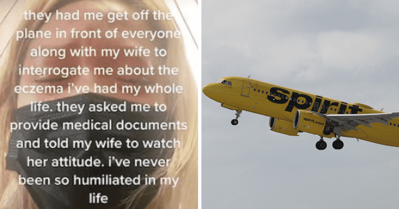Woman thrown out of Spirit Airlines flight after staff mistook chronic eczema for monkeypox