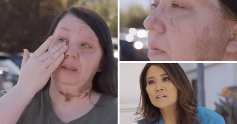'Dr Pimple Popper' Season 8: Dr Sandra Lee meets Casey whose birthmark has kept her from being in photos with her children