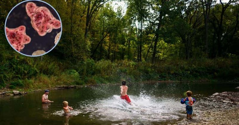 Nebraska child dies due to brain-eating amoeba infection after swimming in Elkhorn River