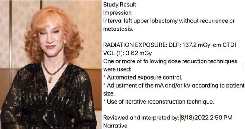 'I know this is crazy': Kathy Griffin posts cancer scan report on SOCIAL MEDIA after doctor 'ghosts' her