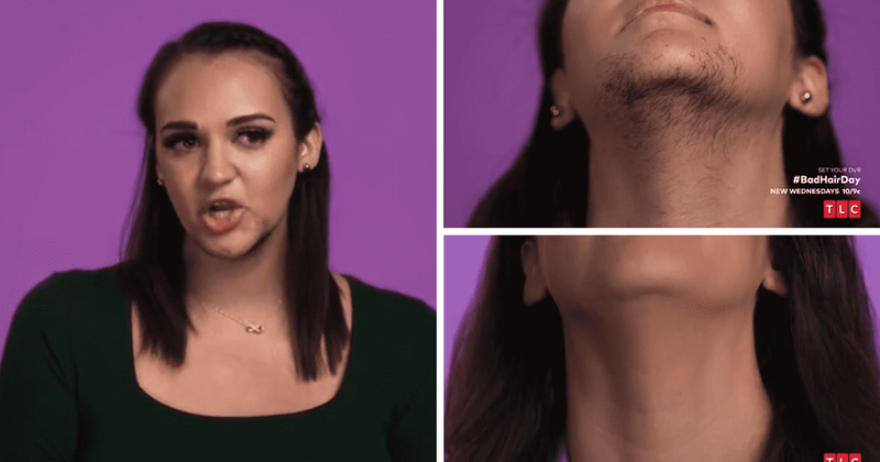 'Bad Hair Day': Dr Isha Lopez helps Charli reconnect with her femininity by removing her excessive facial hair