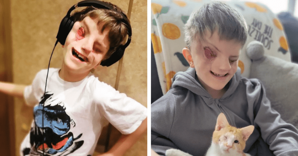 'We cry, pick ourselves up and move on': Mother of son born with ‘no eyes’ takes on sick trolls