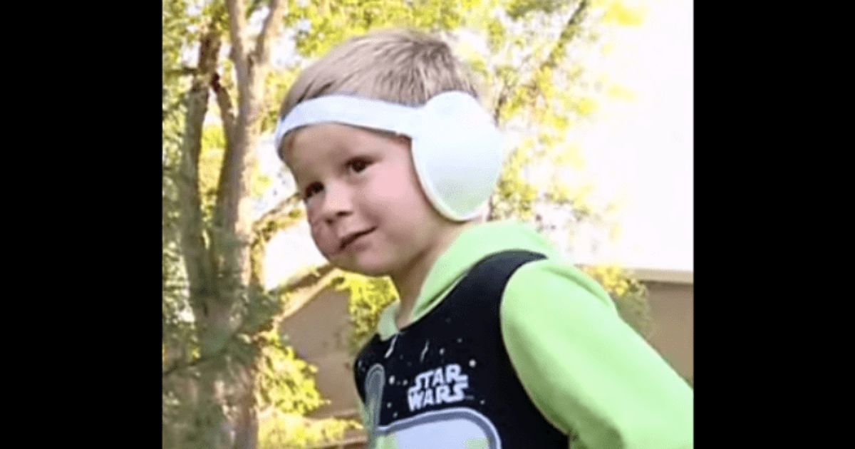 Utah boy, 5, left with severe injuries that required almost 3K stitches after being mauled by dog