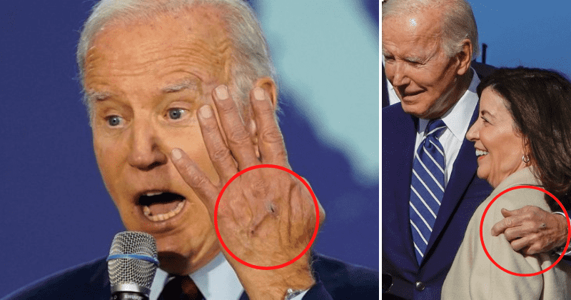 Are those IV puncture holes on Biden's hand? Concerns surround POTUS's health again