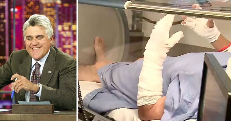 Jay Leno's doc says he is 'optimistic' about TV host's recovery after he was severely burnt in garage fire