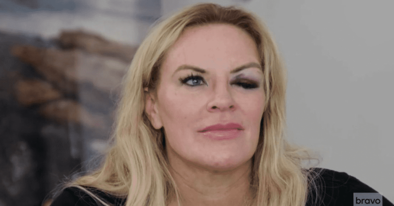 'Who gave Heather a black eye?': 'RHOSLC' fans curious after seeing housewife's bruised eye