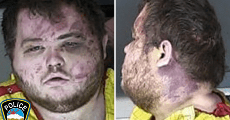 Anderson Aldrich: Club Q shooter looks 'bloody and bruised' in mugshot after being hit on head by bystanders
