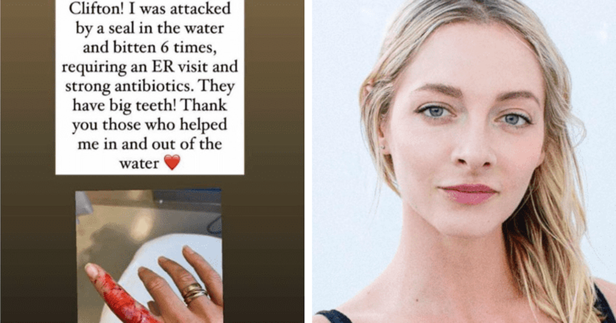 LouLou Taylor: Actress recalls 'Jaws' moment when bitten SIX TIMES by 'angry' beach seal while swimming