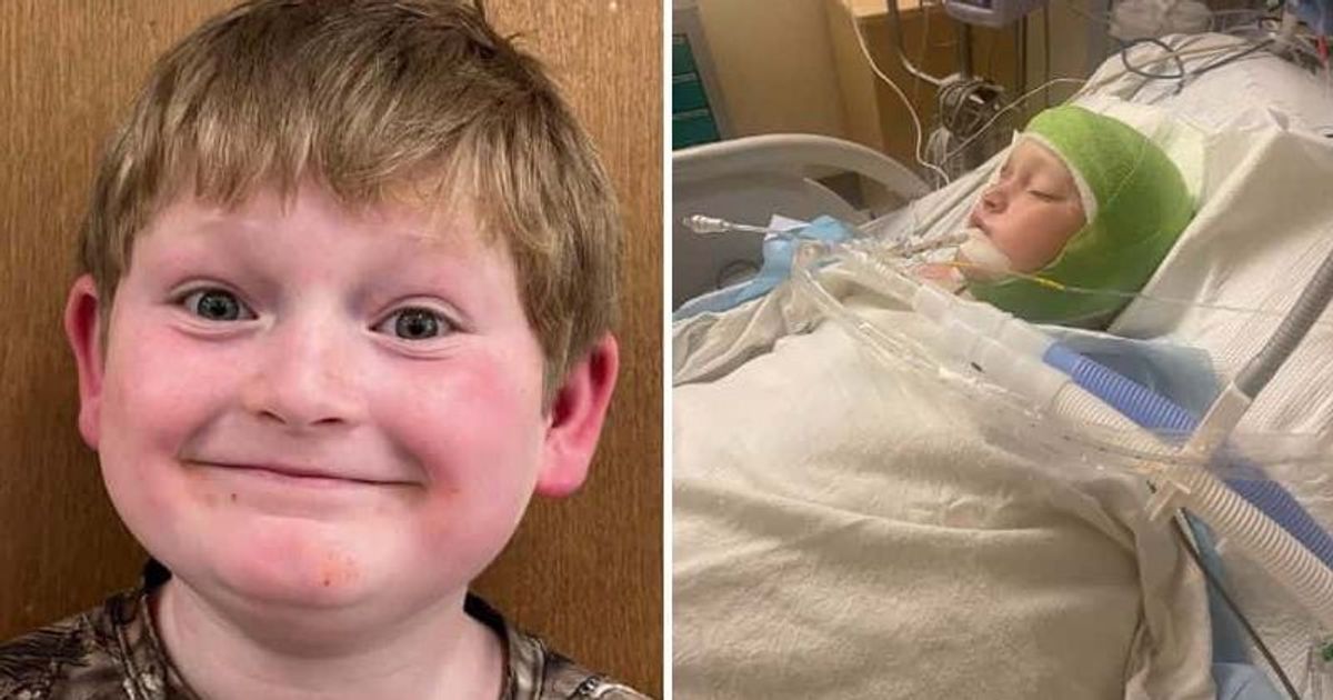 'A living nightmare': Georgia boy mauled by three pit bulls fights for life after losing 70% of his scalp