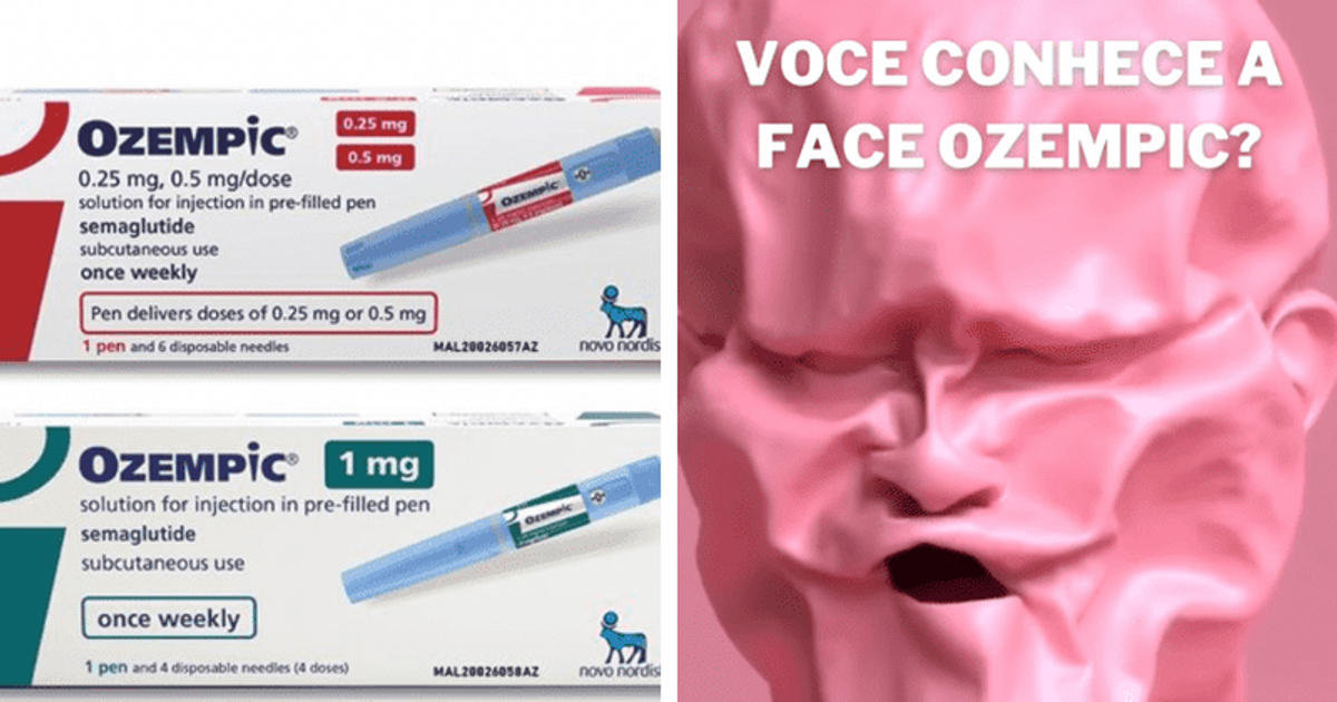 What is Ozempic face? Doctors explain how miracle weight loss drug makes you look OLD