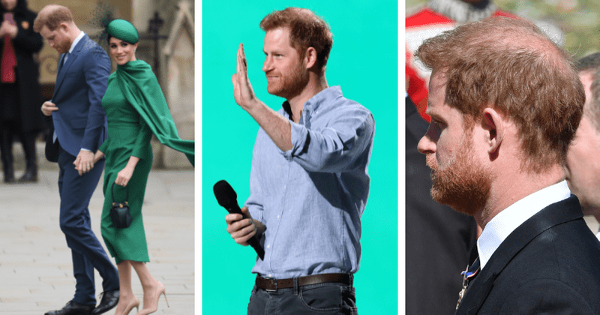 Is stress of moving to US making Prince Harry go bald? Doc’s shocking