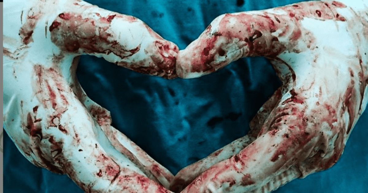 Millions of bloody, used nitrile gloves being sent to US dubbed ‘most