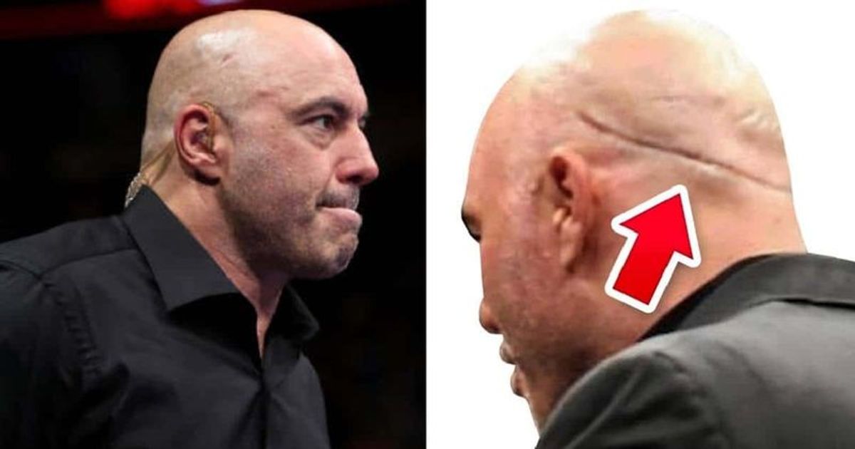 What happened to Joe Rogan? Why does podcaster have 'big scar' on the